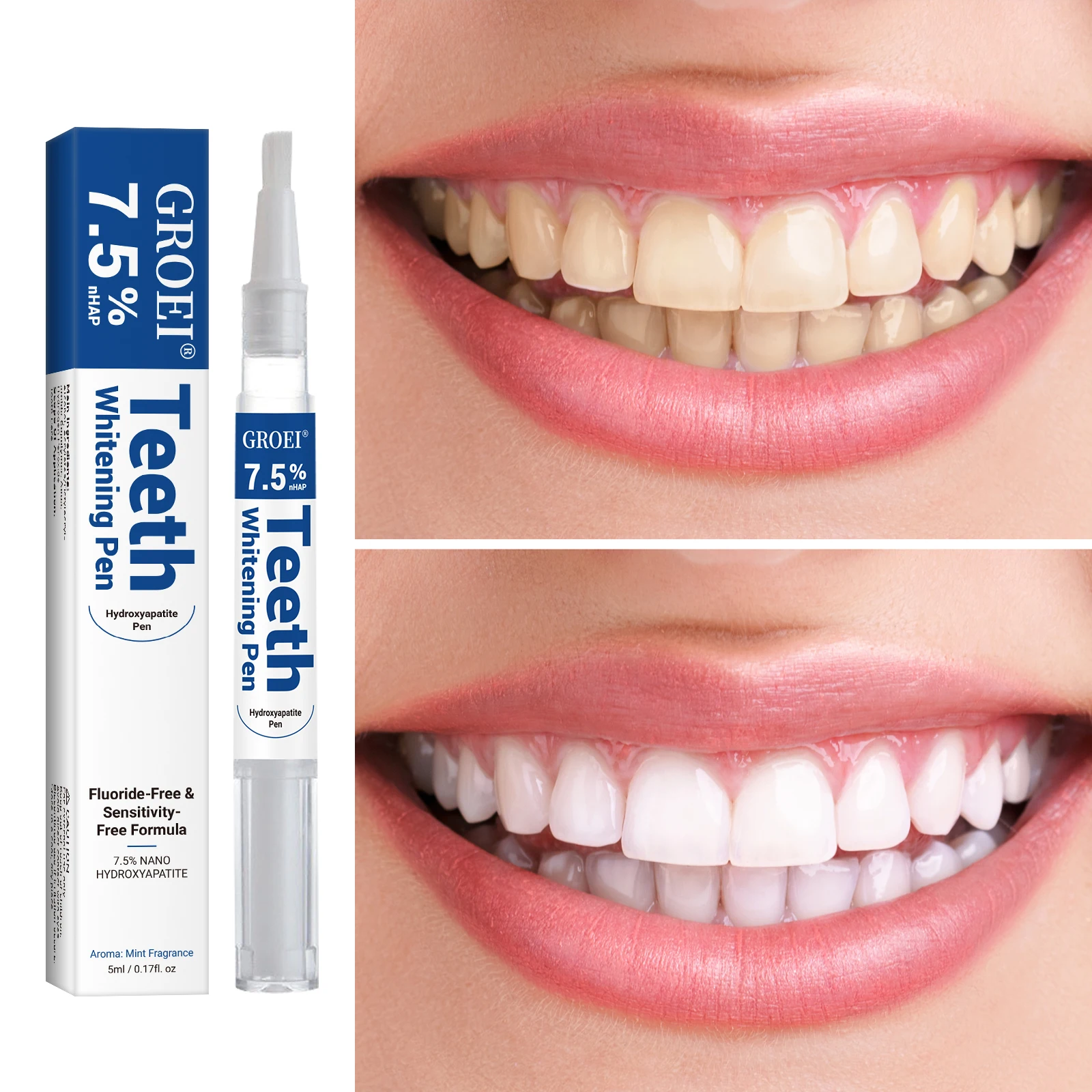 Hydroxyapatite Tooth Whitening - Teeth Whitening Near Me recension och pris