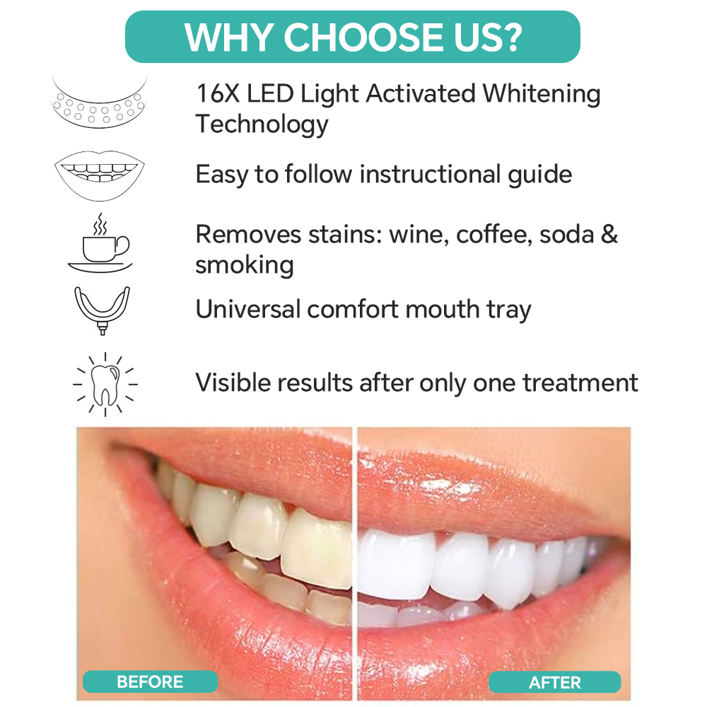 Teeth Whitening Enhancer Light - Led Mouth Tray recension och pris