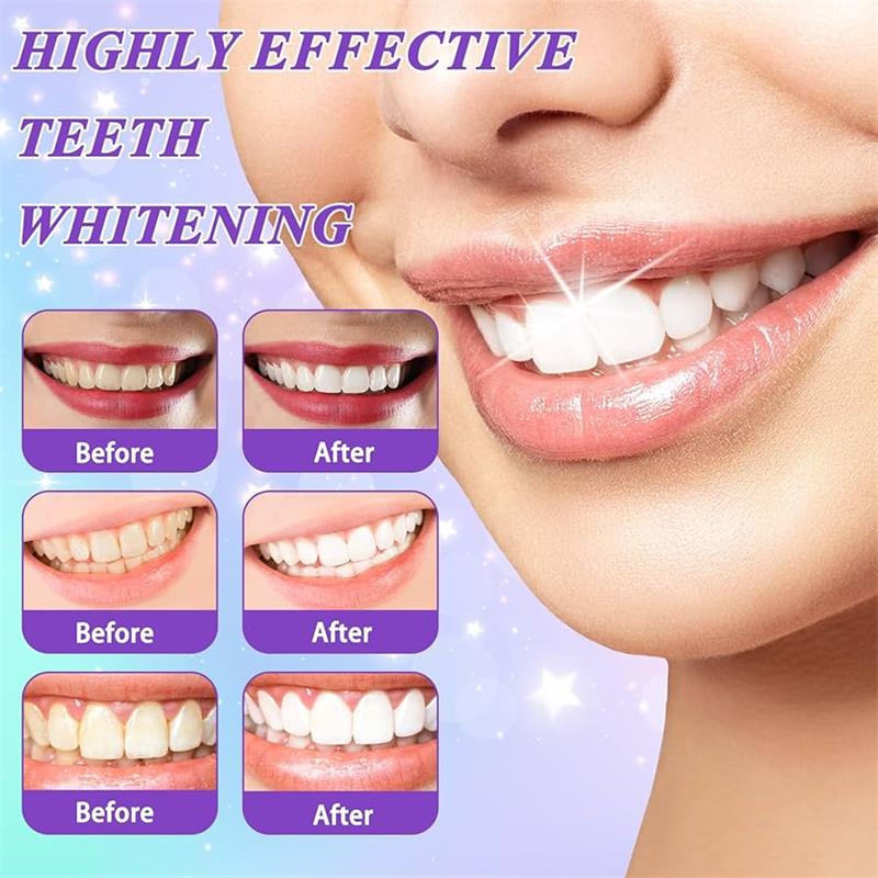 9D Purple Teeth Whitening Toot - Teeth Whitening Treatment recension och pris