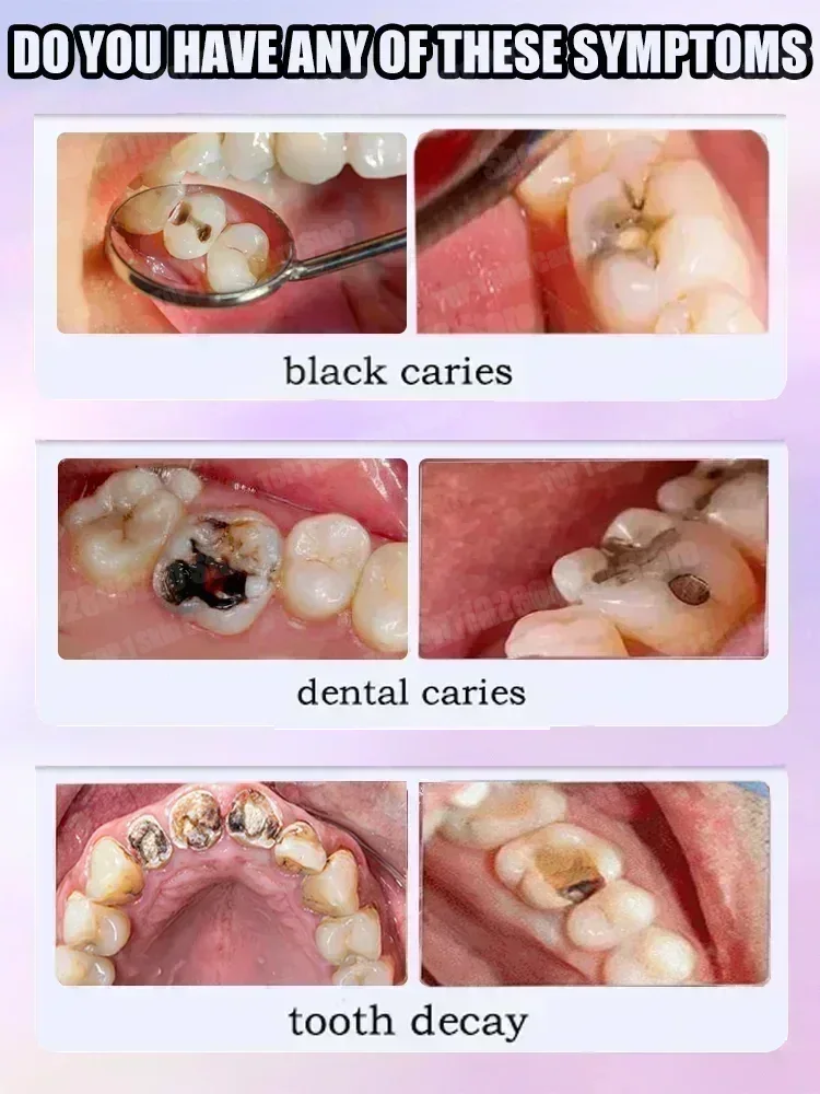 Hot sales Best-selling, Scient - Teeth Whitening Treatment recension och pris