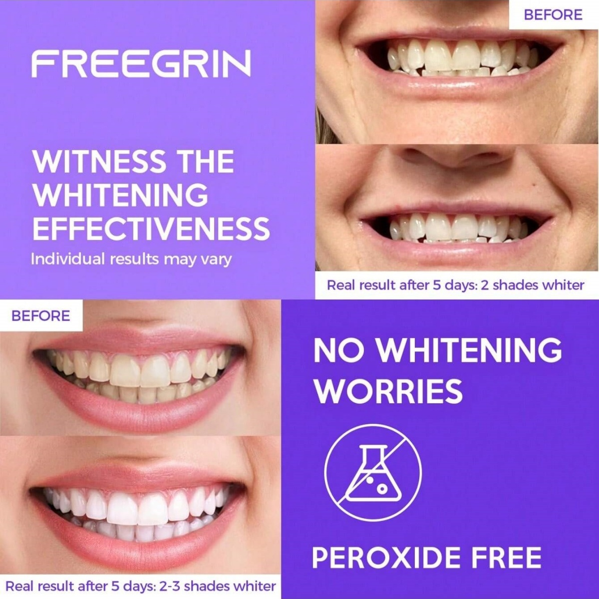 Deluxe Whitening Teeth Sticker - Teeth Whitening Near Me recension och pris